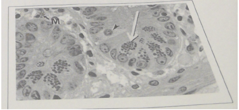 26\. The vesicles indicated by the arrow