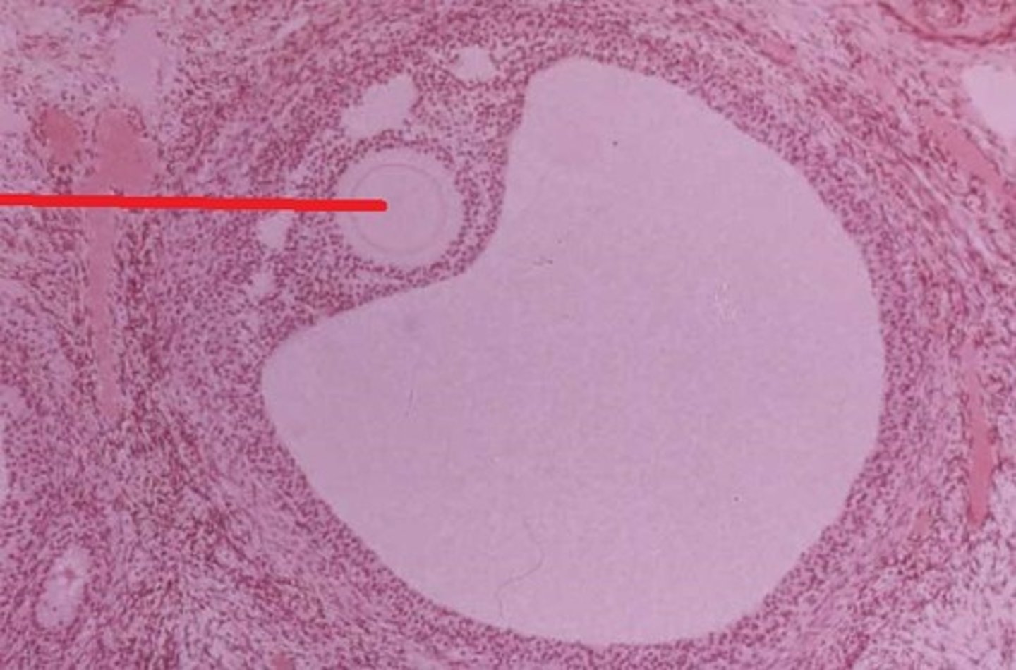 <p>small dot in the oocyte</p>