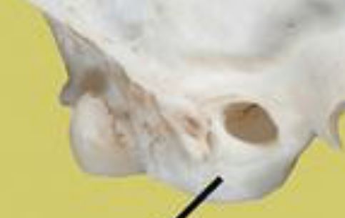 <p>Hollow, rounded structure in the skull partly enclosing the middle and inner ear.</p>