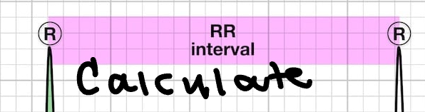<p>Formula?</p>