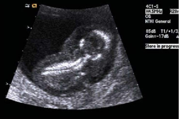 term image