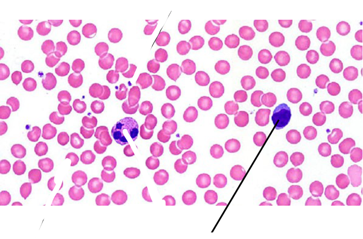 <p>What Type of connective Tissue is this?</p>