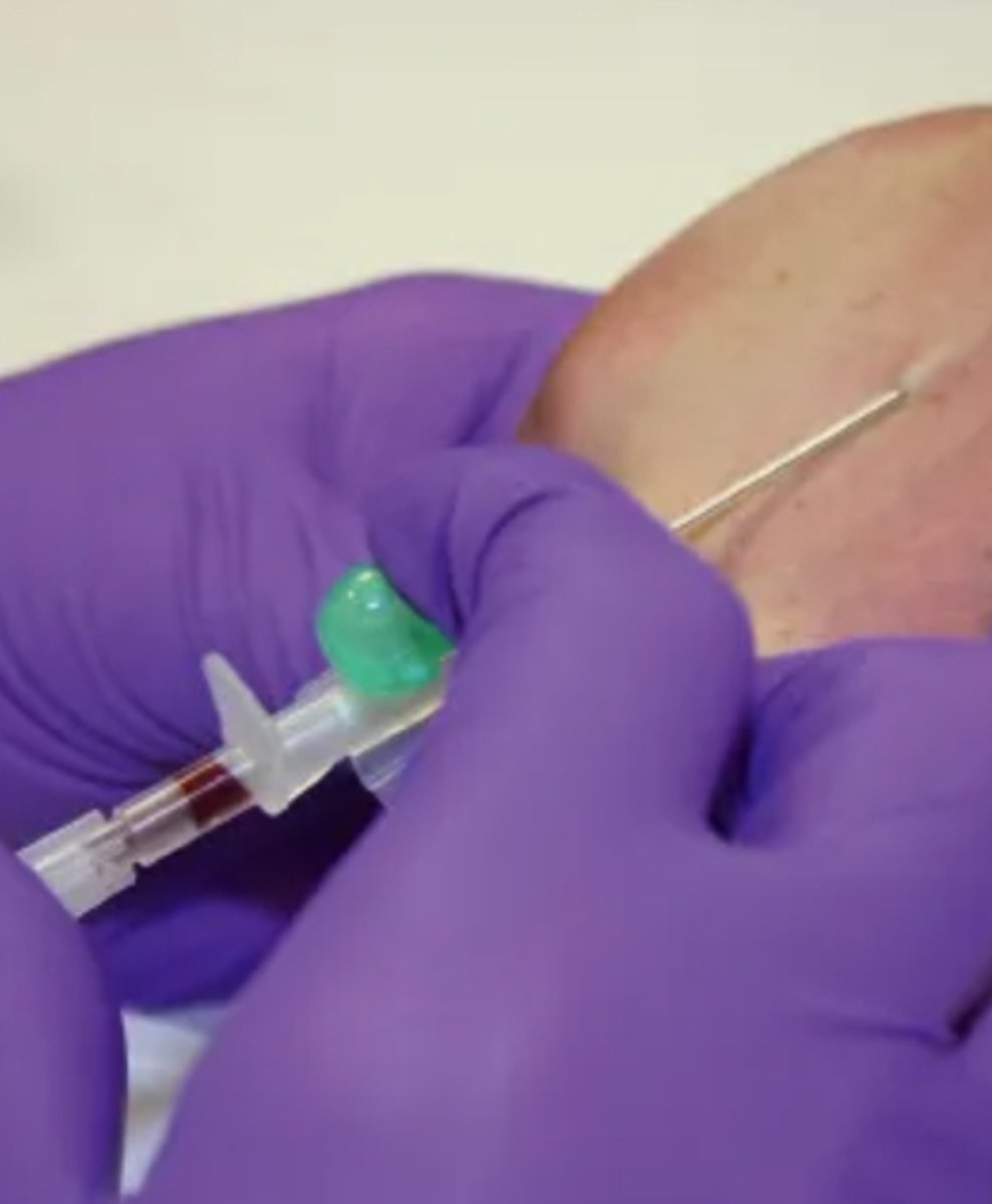 <p>Blood flashback</p>