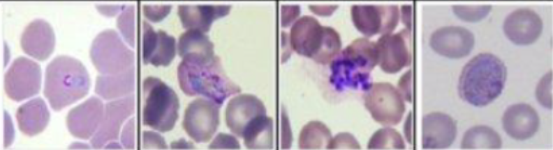 <p>What parasite is this?</p>