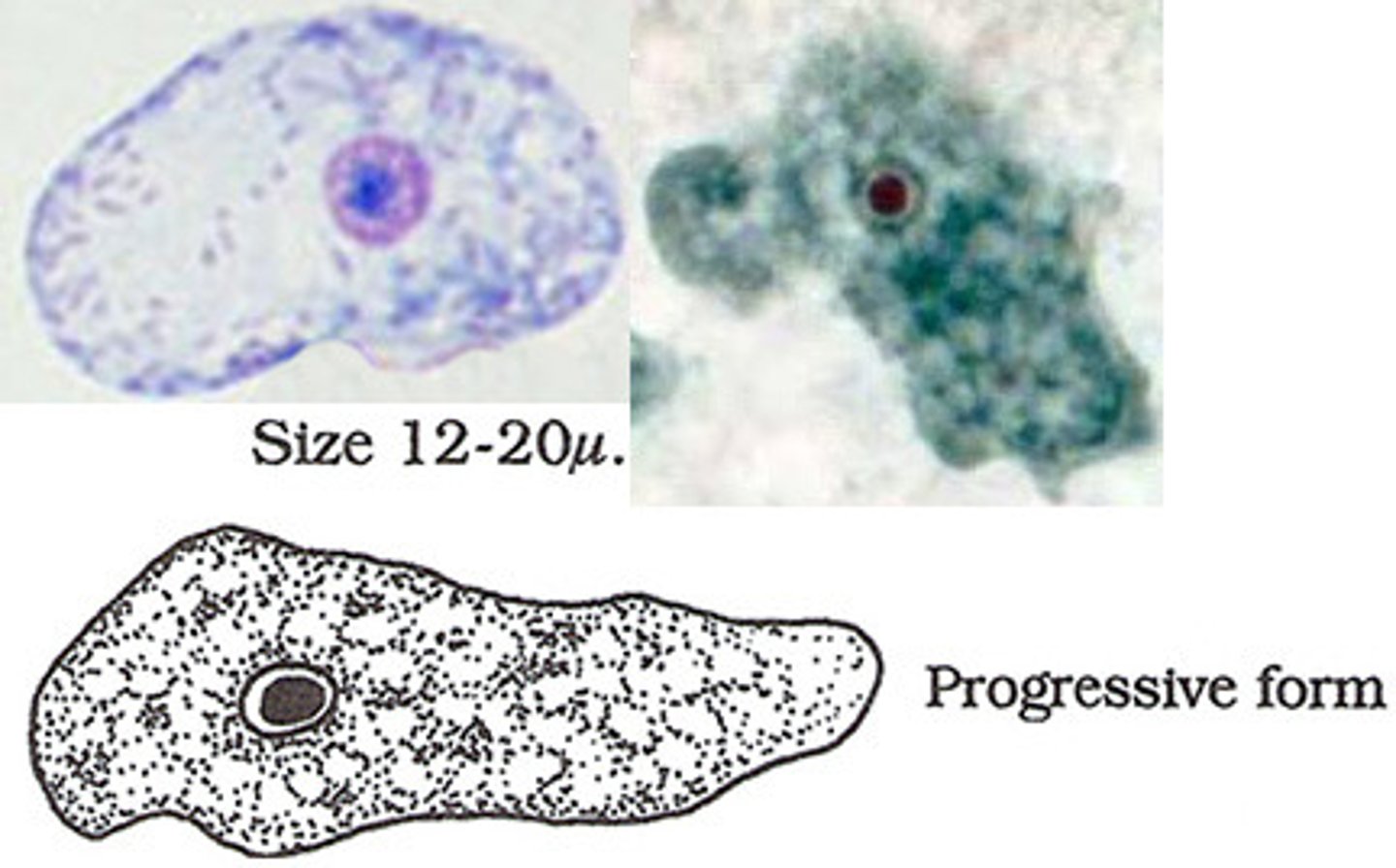 <p>change body forms based on how much food is in the environment</p><p>Non-amoeboid body form (flagella) is better suited for movement so is common when food source is absent or scarce</p><p>amoeboid body form is better suited for eating and so is common when food source is present</p><p>certain genes/body forms expressed @ certain environments (nutrient level) → need to get around faster to go longer distances to find food when nutrients decrease (amoeboid form very slow compared to flagellate)</p><p>problem with phylogeny bc of this</p><p>not photosynthetic</p>