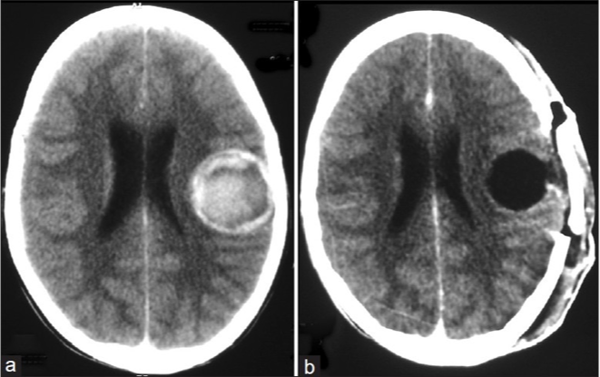 <p>What does this refer to </p>