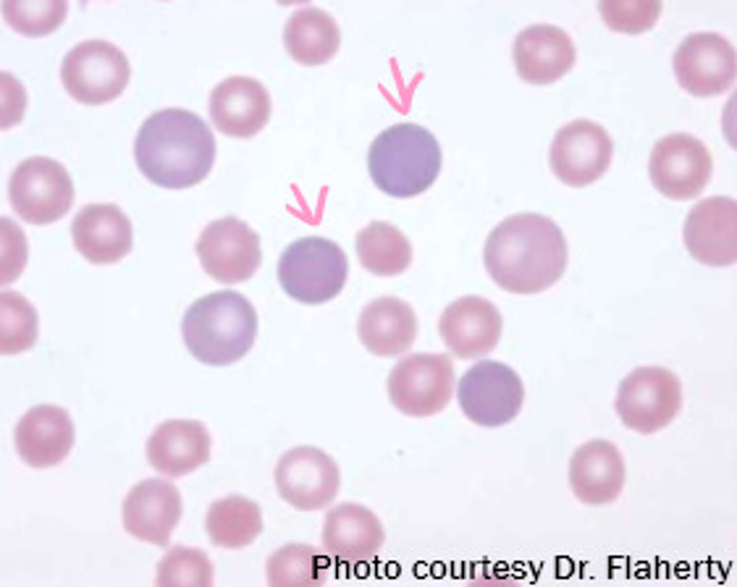 <p><strong>Immature red blood cells that lack a nucleus but are larger in size than a mature red blood cell and have a purplish color</strong></p><p>*the purplish color is picking up residual RNA up Azure B in Wright Stain ) </p>