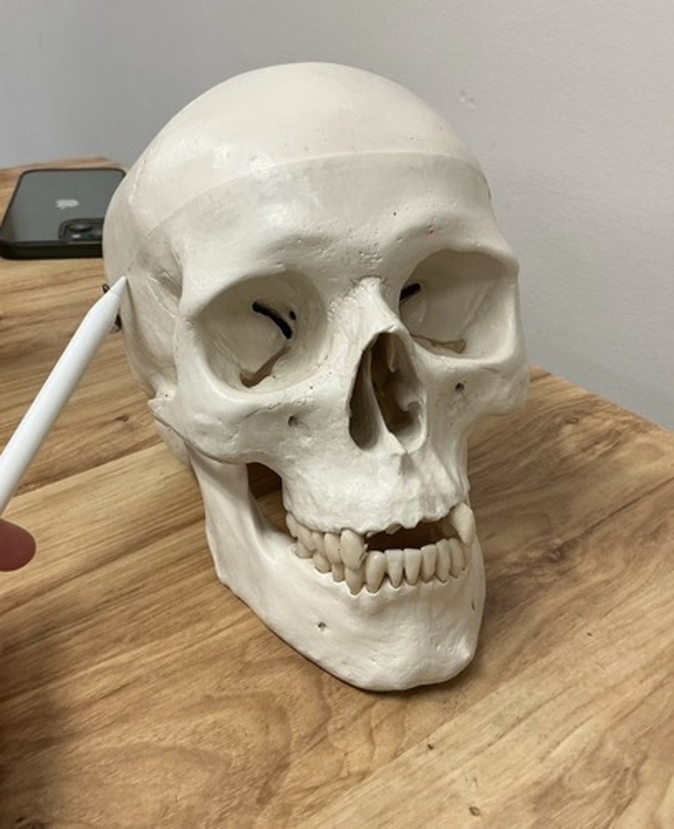 <p>What suture is this?</p>