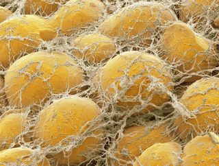 <p>Cells that store extra materials from food that can be turned into energy later.</p><ul><li><p>Provides insulation</p></li><li><p>Surrounds vital organs and tissues</p></li><li><p>Fills sharp angles between bones and muscle</p></li></ul><p></p>