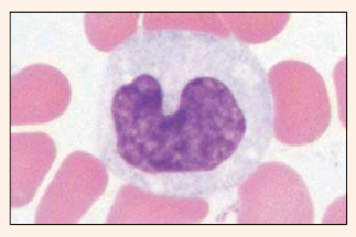 <p>Identify the blood cell</p>