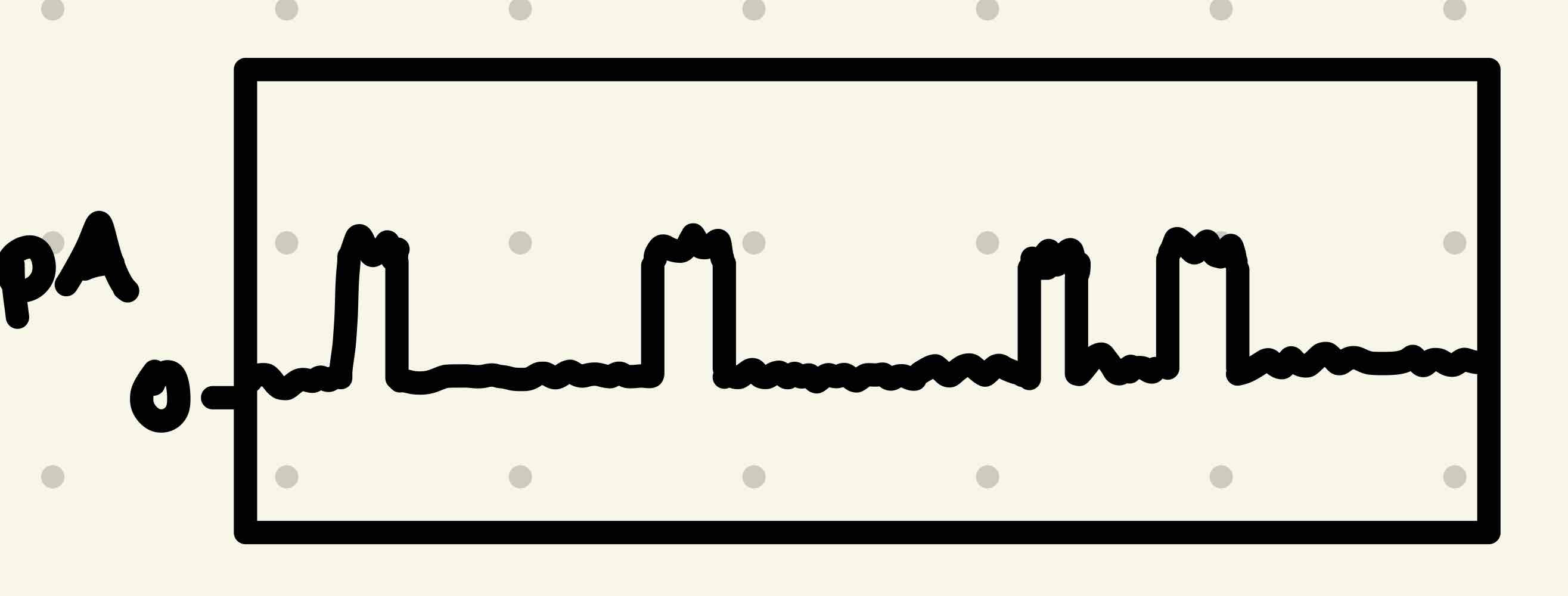 <p>You have patch-clamped a single voltage-gated ion channel in a membrane and have obtained the recording. Sketch the recording you would expect to see if you repeated the experiment but with two molecules of the same voltage-gated ion channel. Briefly explain your results. </p>