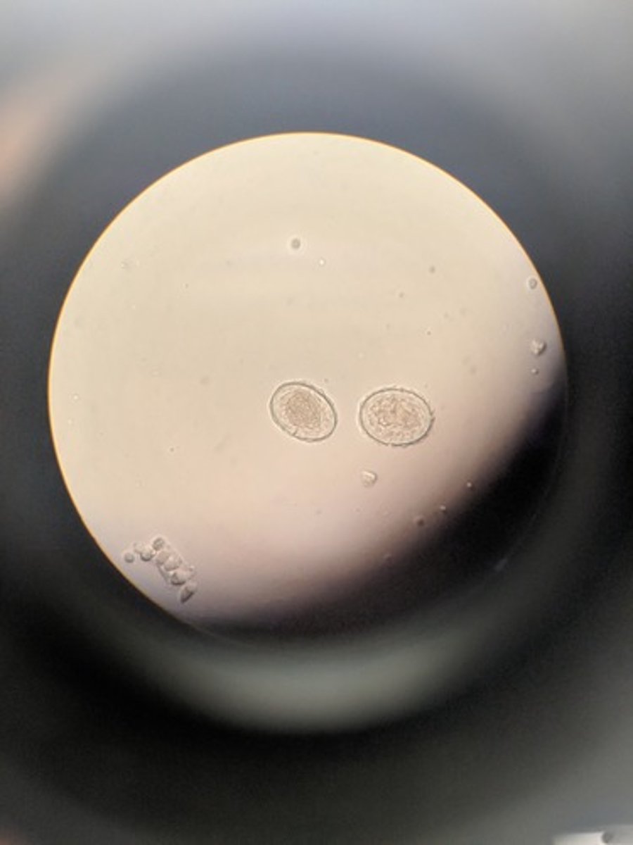 <p>Eggs = infective form</p><p>dx: fecal exam for eggs</p>