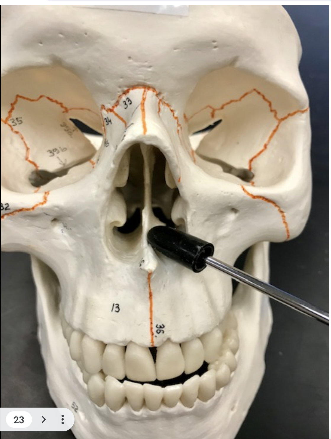 <p>Where is the pointer indicating </p>