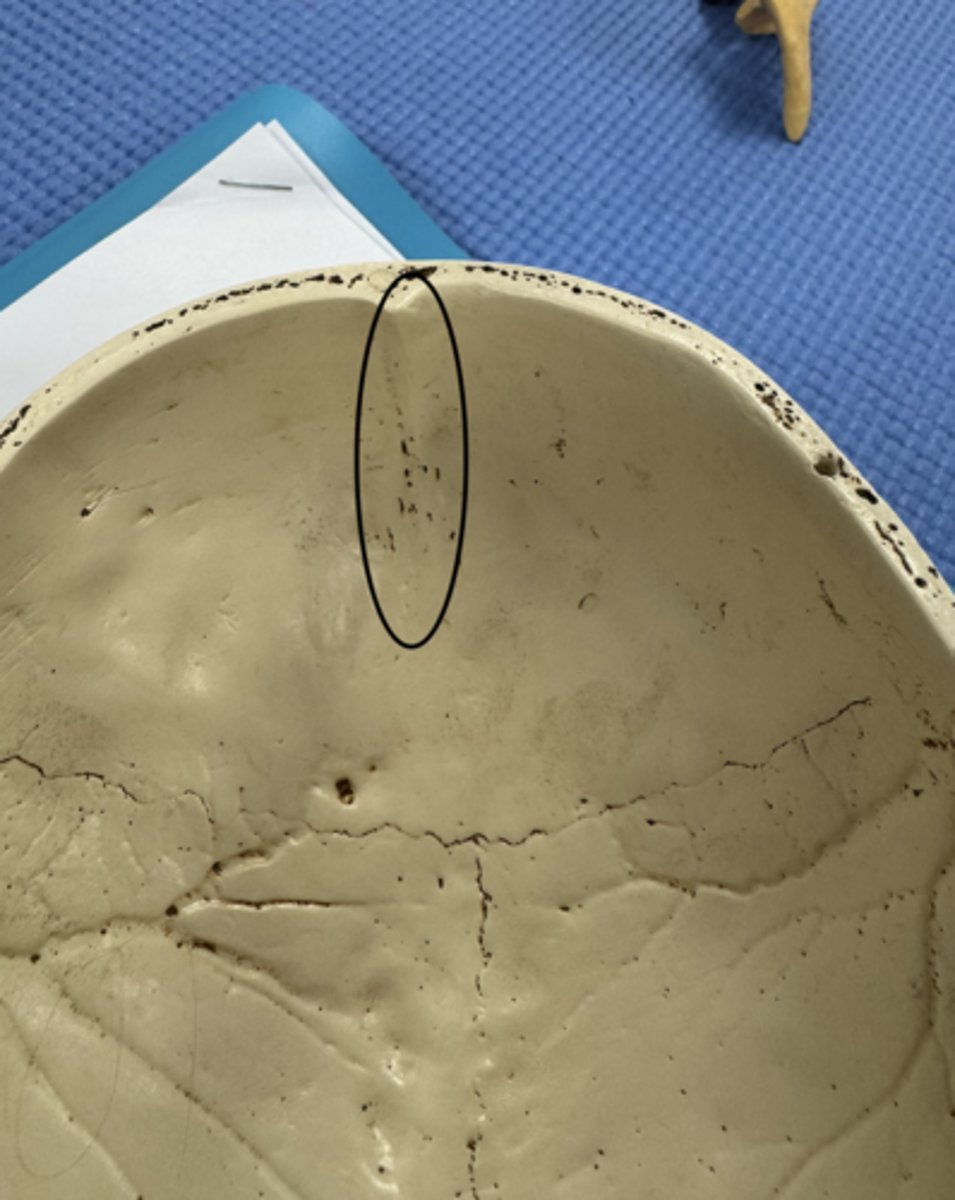 <p>seen inferiorly</p>