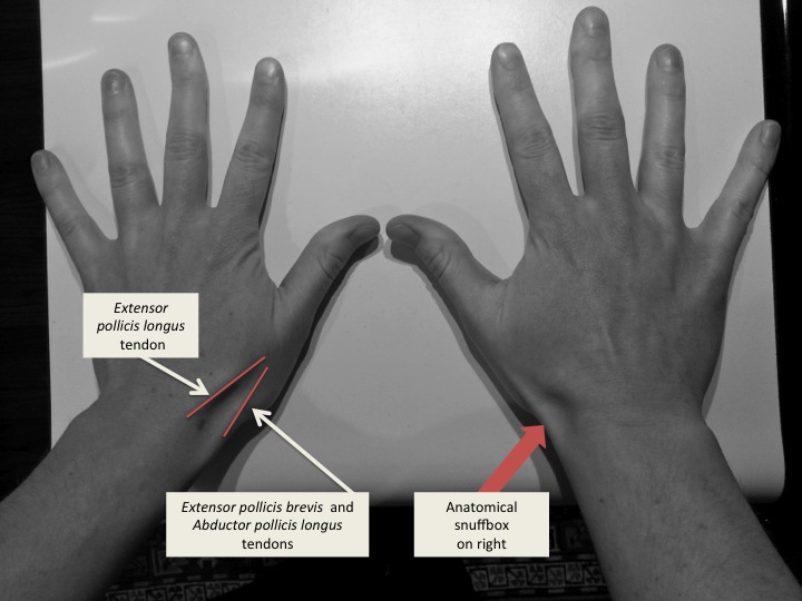 <p>A triangular depression on the back of the hand, at the base of the thumb</p>