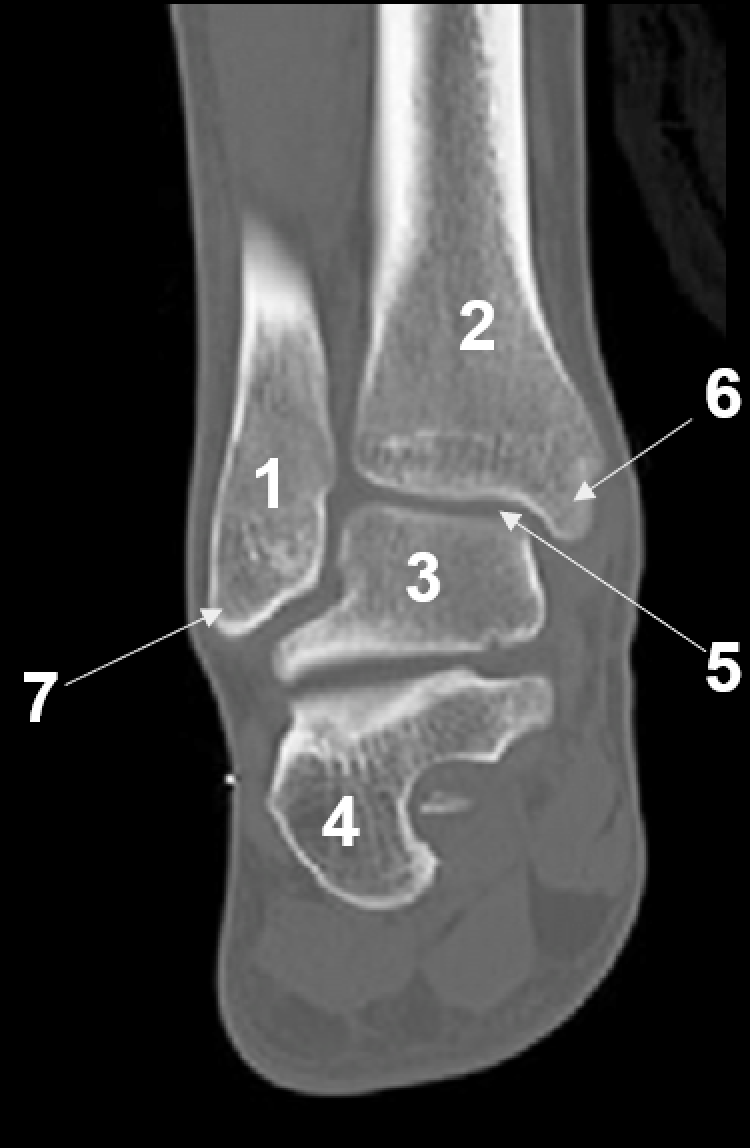 <p>5</p>