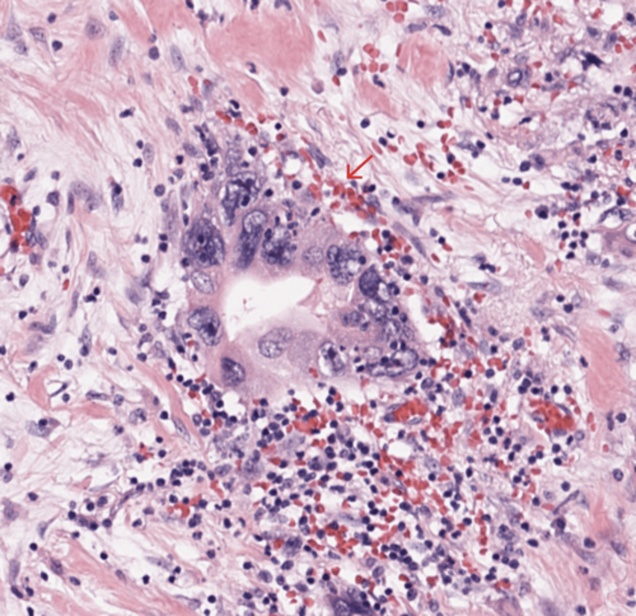 <p>Pancreas</p>