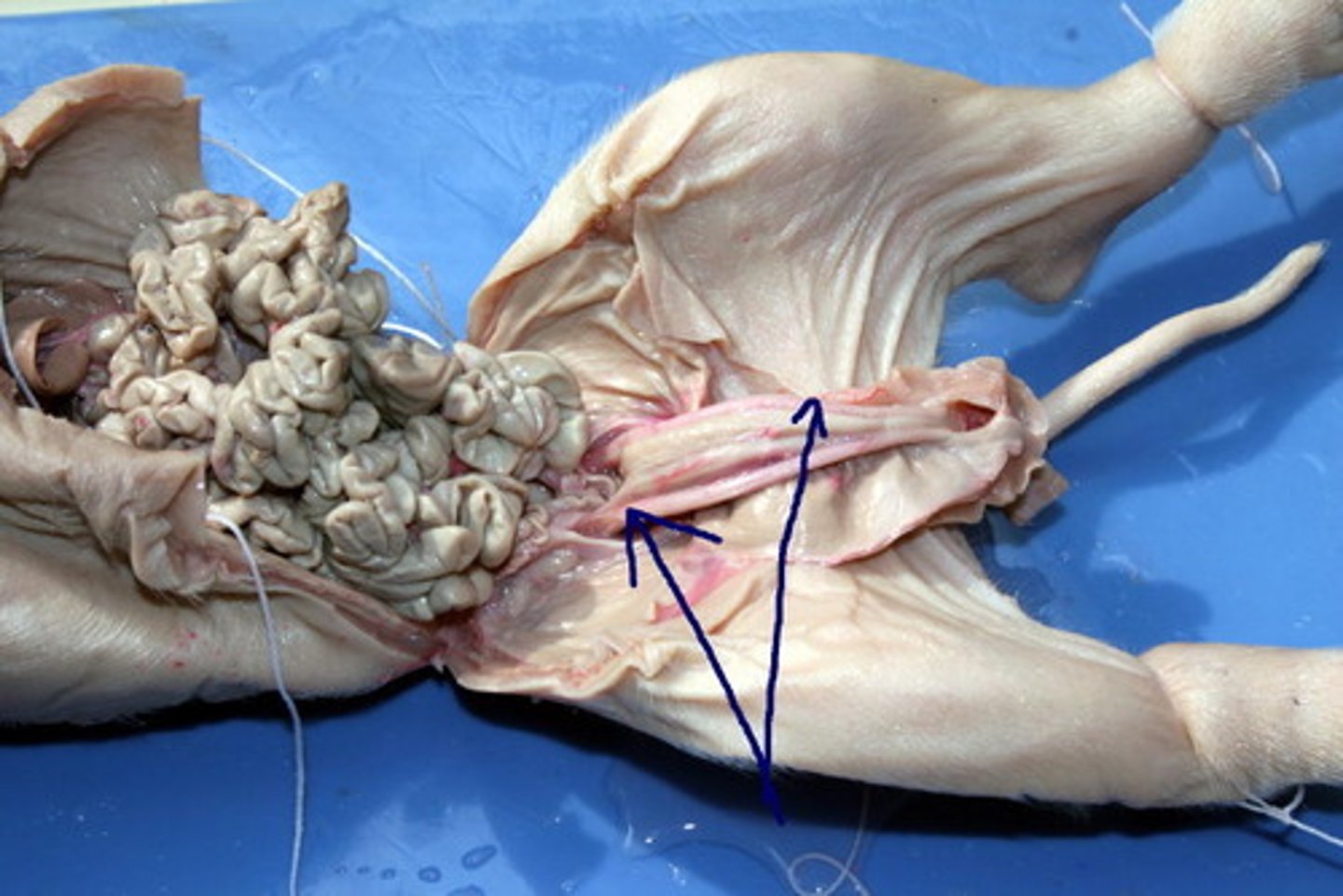 <p>carry deoxygenated blood from the fetus to the placenta</p>