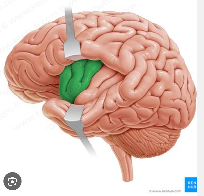 term image