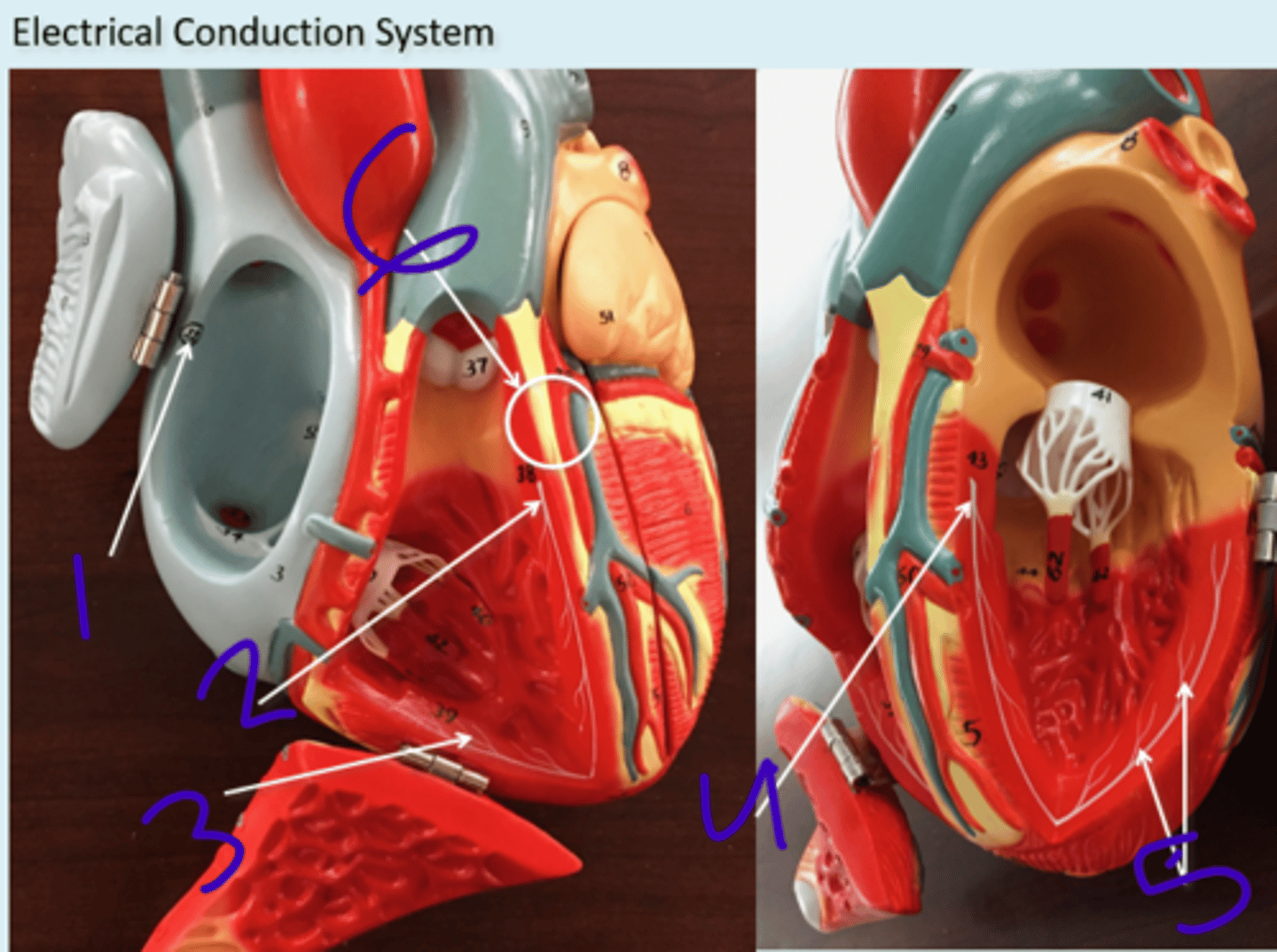 <p>Electrical conduction system 2 - #1</p>