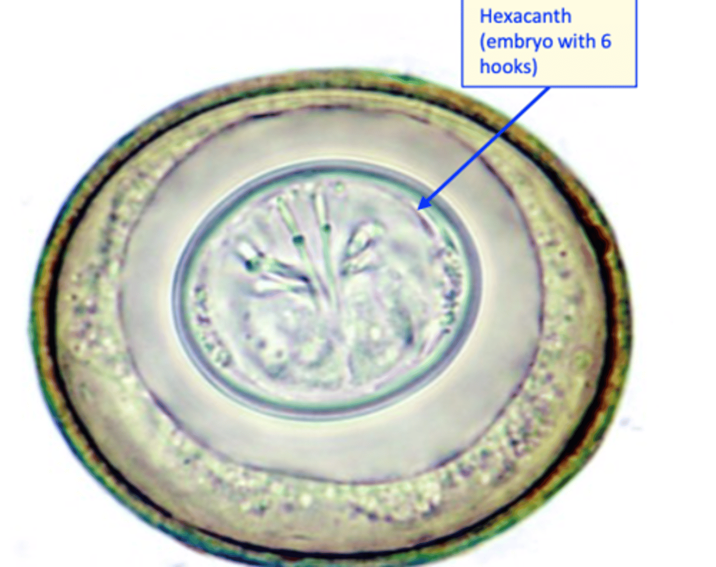 <p>• Clinical signs: not specific</p><p>• History</p><p>• Finding proglottids/eggs in the faeces</p>