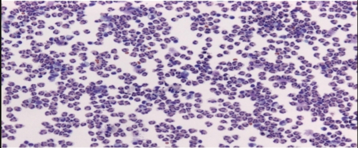 <p>What is this and What are the main cells seen in it?</p>