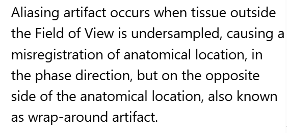 <p>A. Aliasing artifact</p>