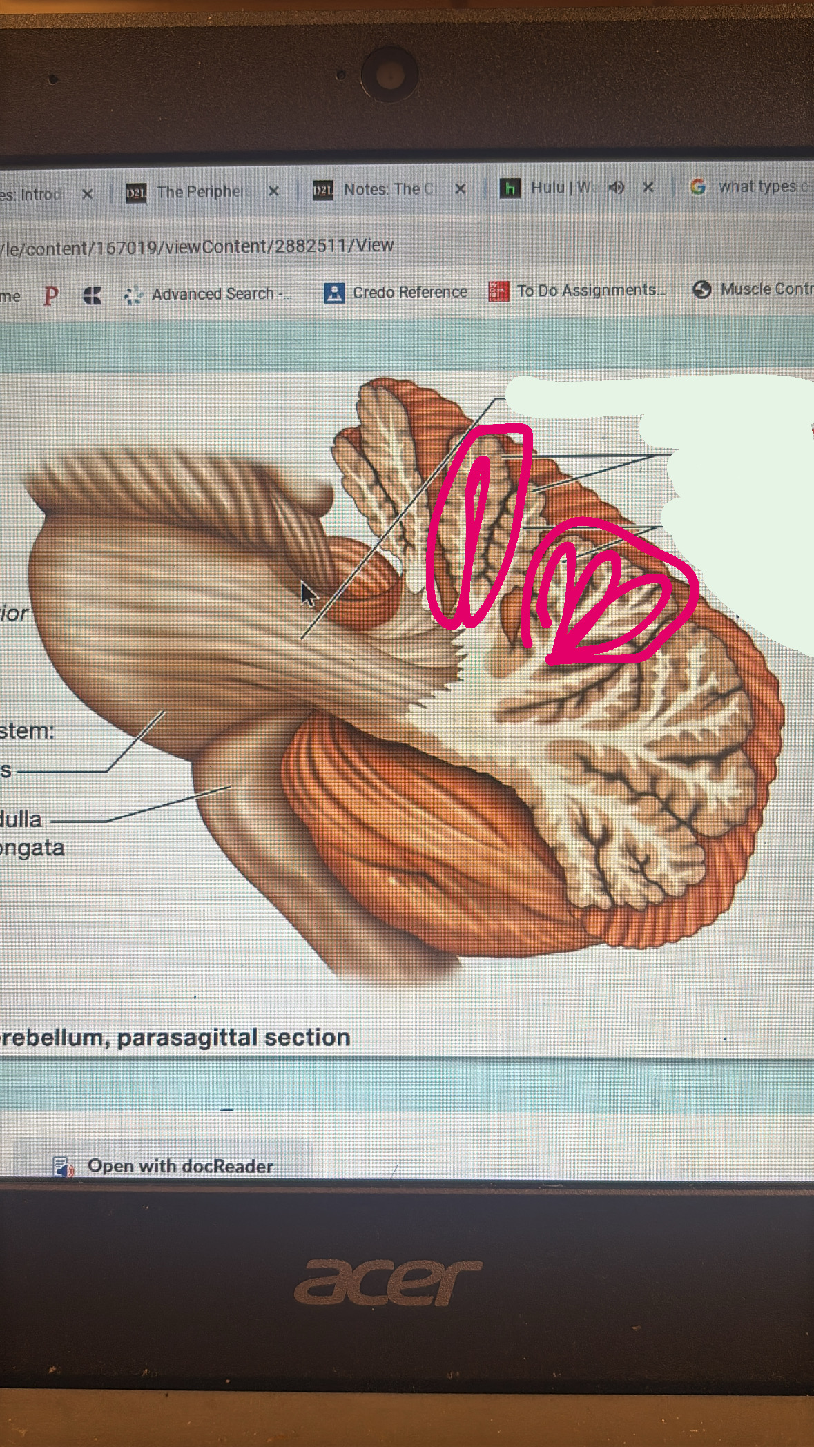 <p>the grey matter in the cerebellum</p>