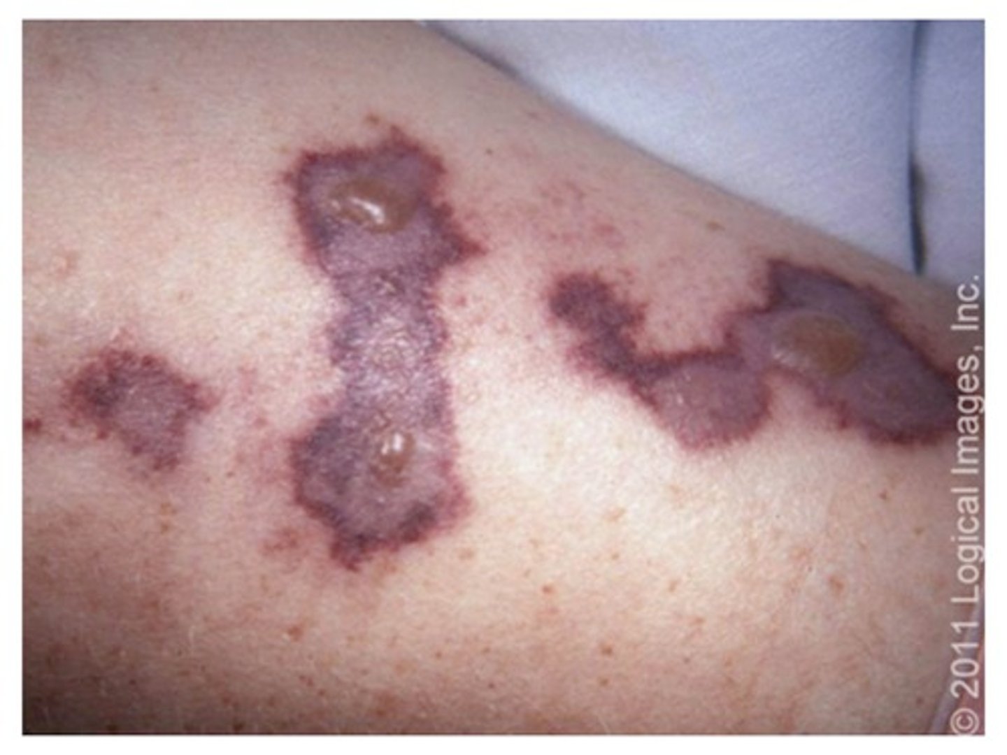 <p>Identification of an injury or disease</p>