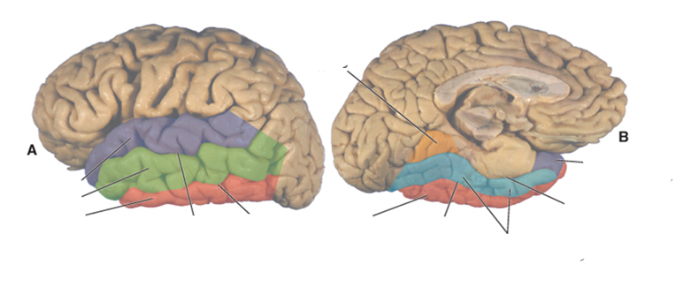 <p>what color is the inferior temporal gyrus?</p>