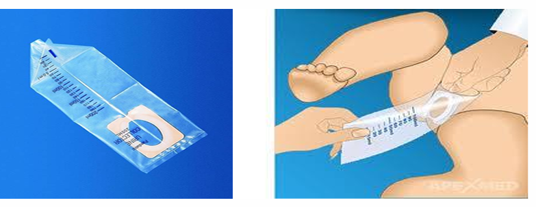 <p><strong>Sterile Urine Collection Bag (Pediatric Urine Collector)</strong></p>