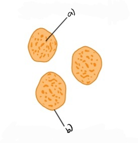 Label the following diagram of lysosomes