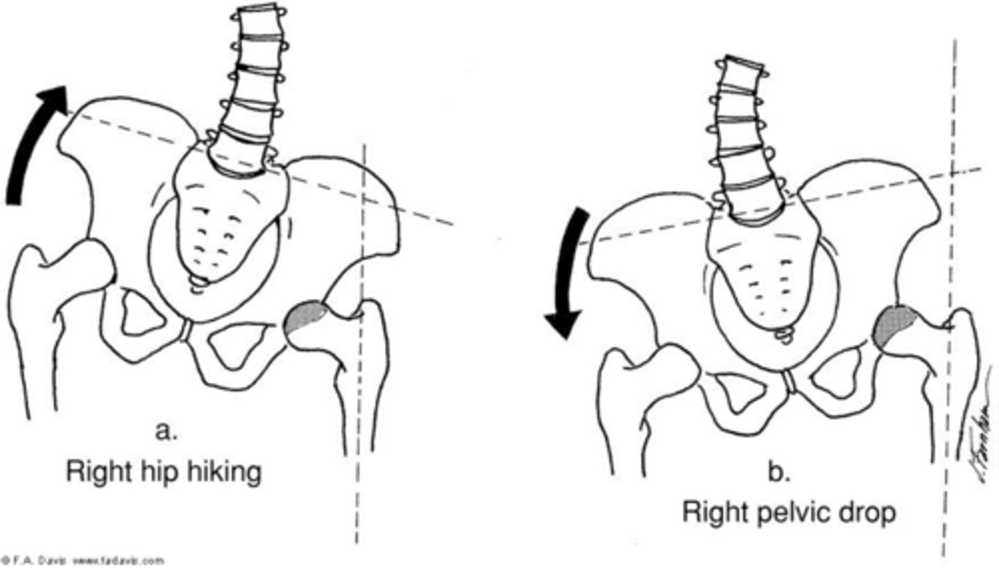 <p>adduction of stance limb</p><p>(B IN IMAGE)</p>