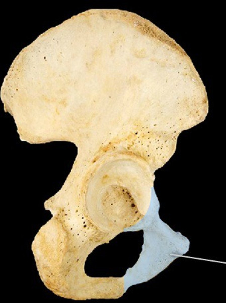 <p>ID bone in gray</p>