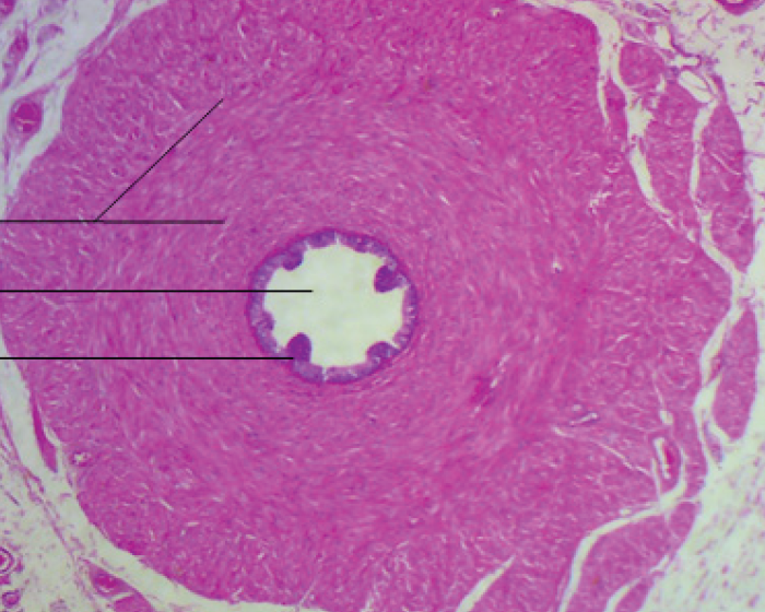 <p>Identify the organ in the micrograph</p>