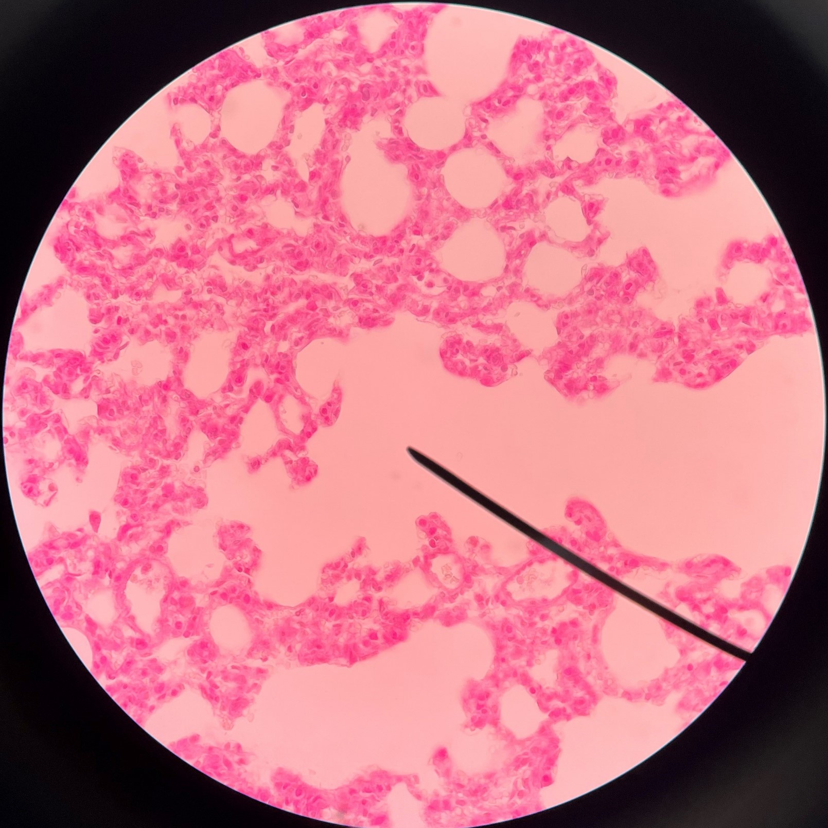 • Clusters of alveoli.

• Led into by the alveolar ducts.