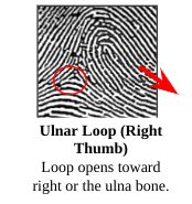 <p>Ulnar Loop</p>