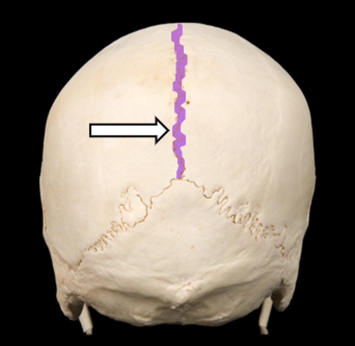 <p>name the part</p>