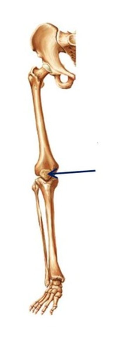 <p>ID bone</p>