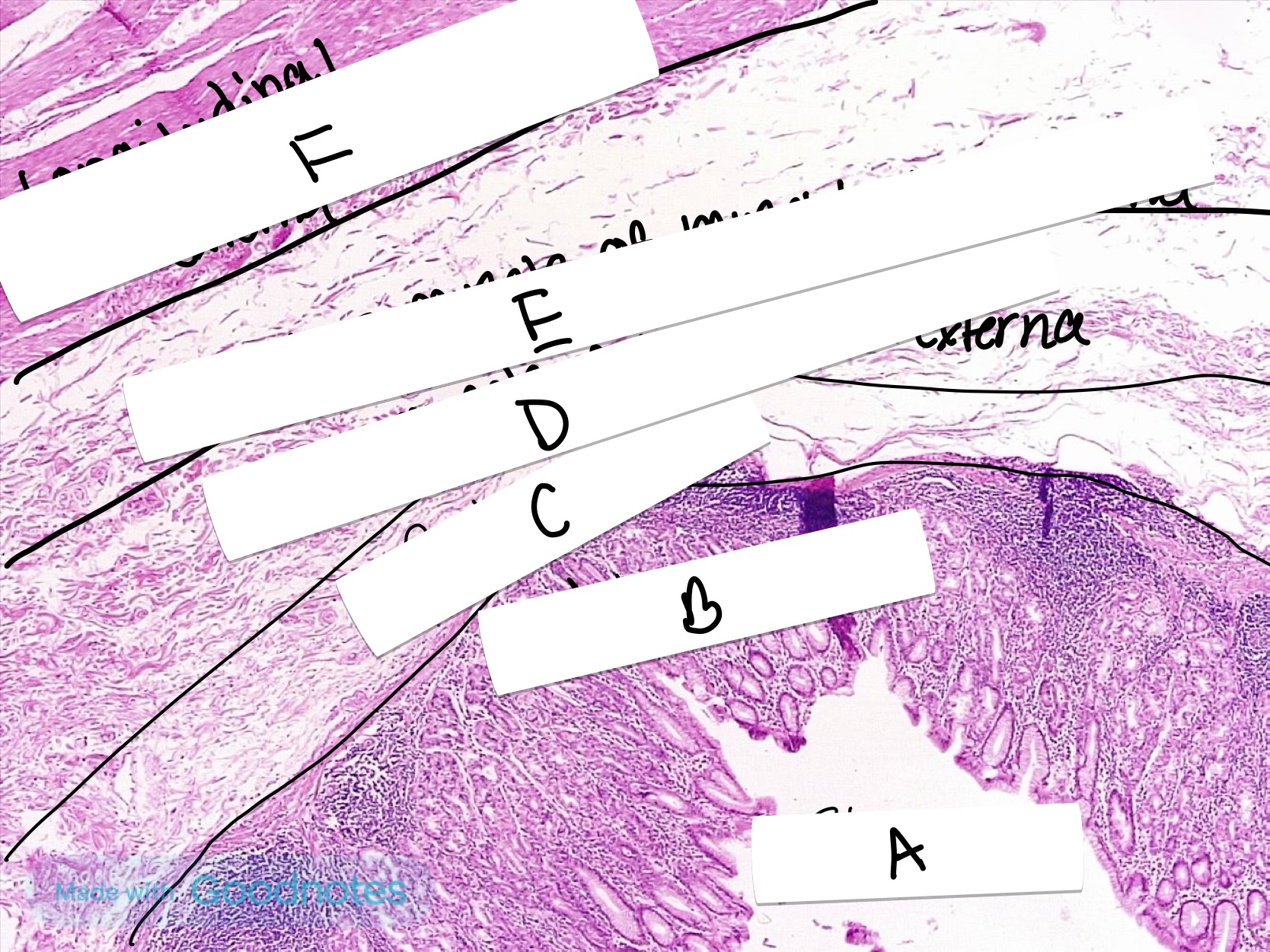<p>What is the name of this organ labeled A</p>