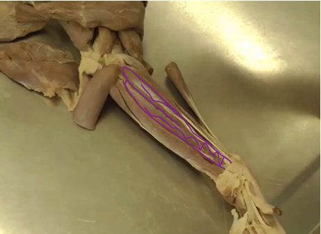 <p><span>Antebrachial Region (Forearm)</span></p>