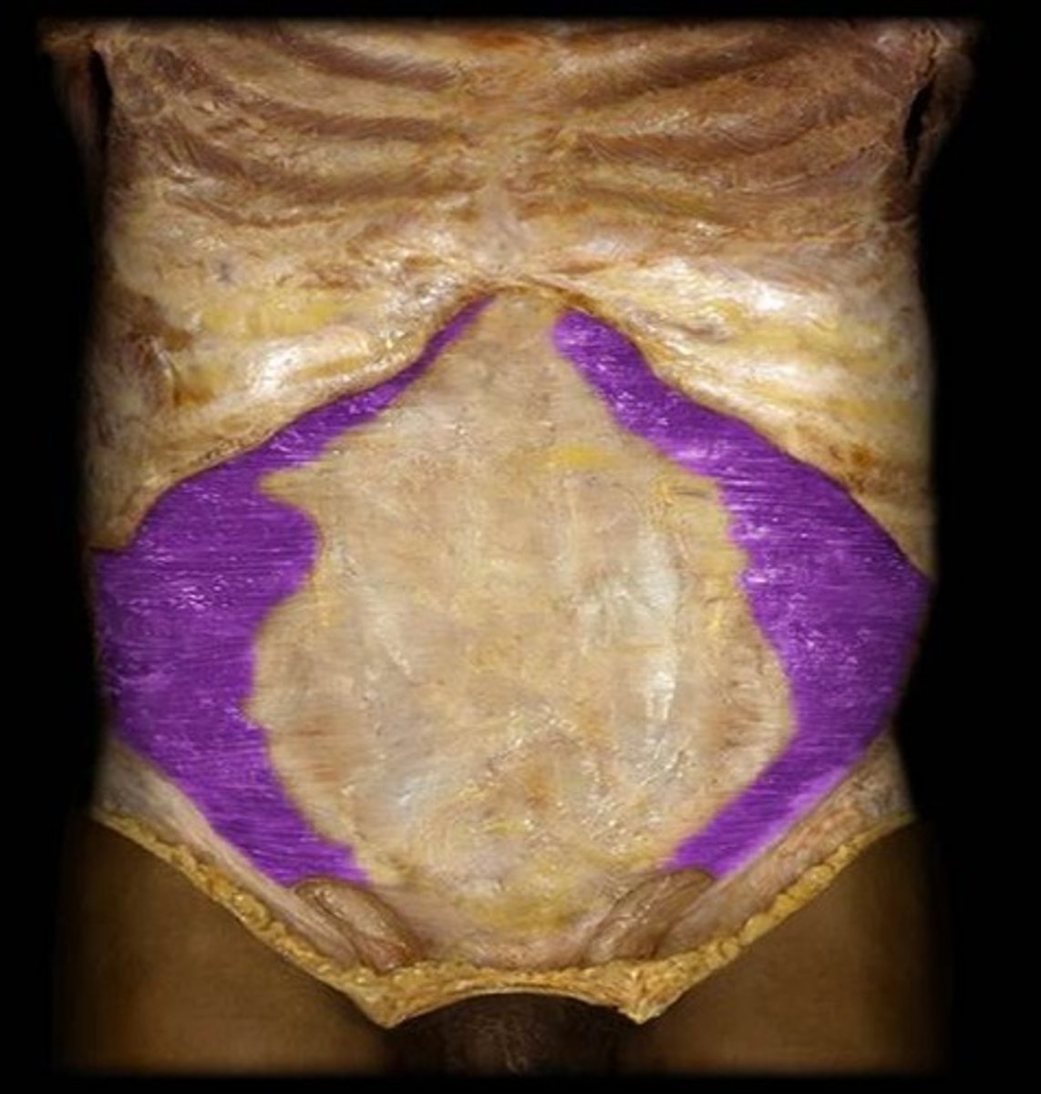 <p>What is the name of this muscle, highlighted in purple?</p>