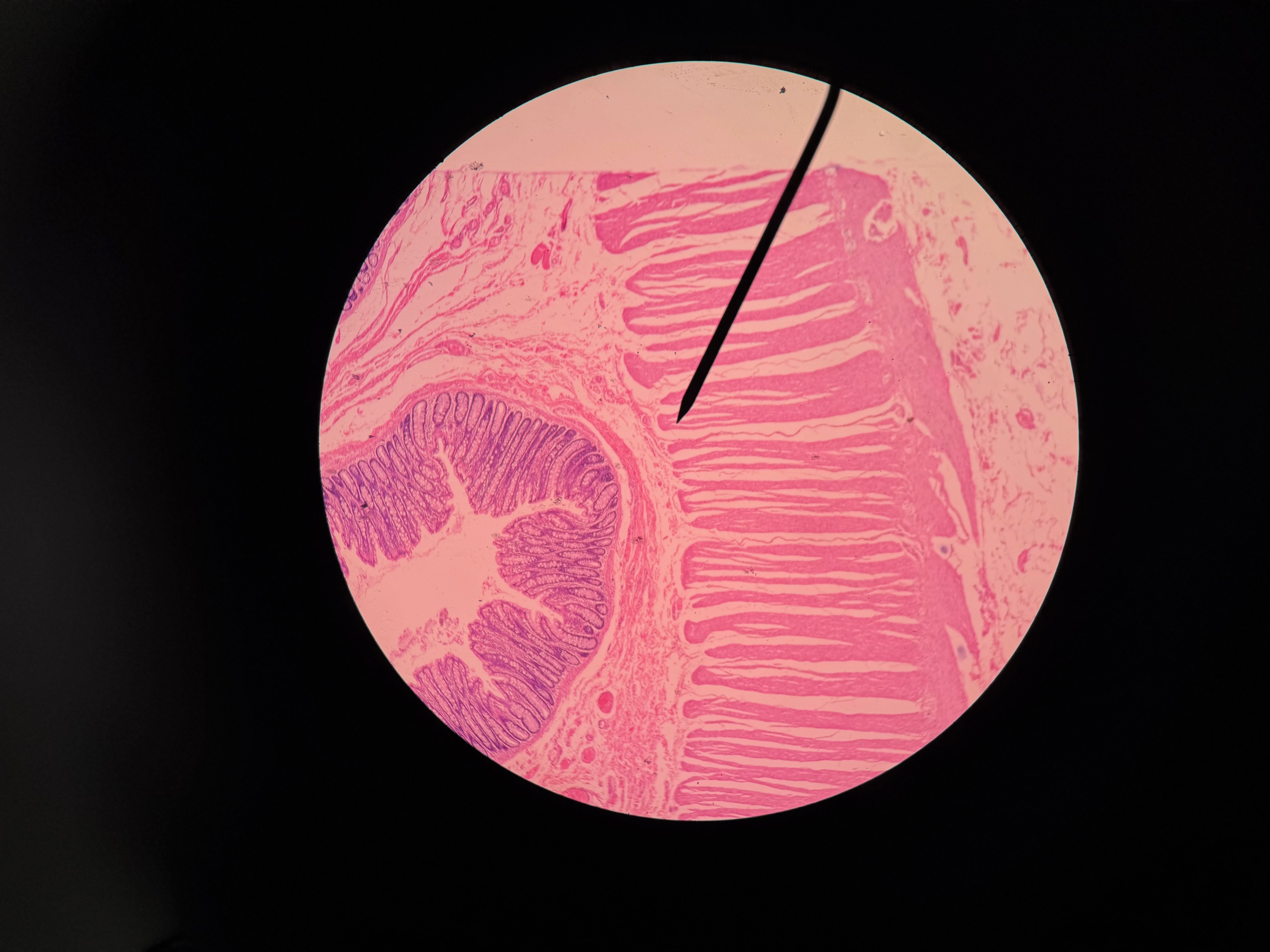 <p>Organ?</p><p>Structure between muscular layers?</p>