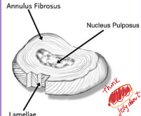 <p>Anatomy of the disk (IVDD)</p>