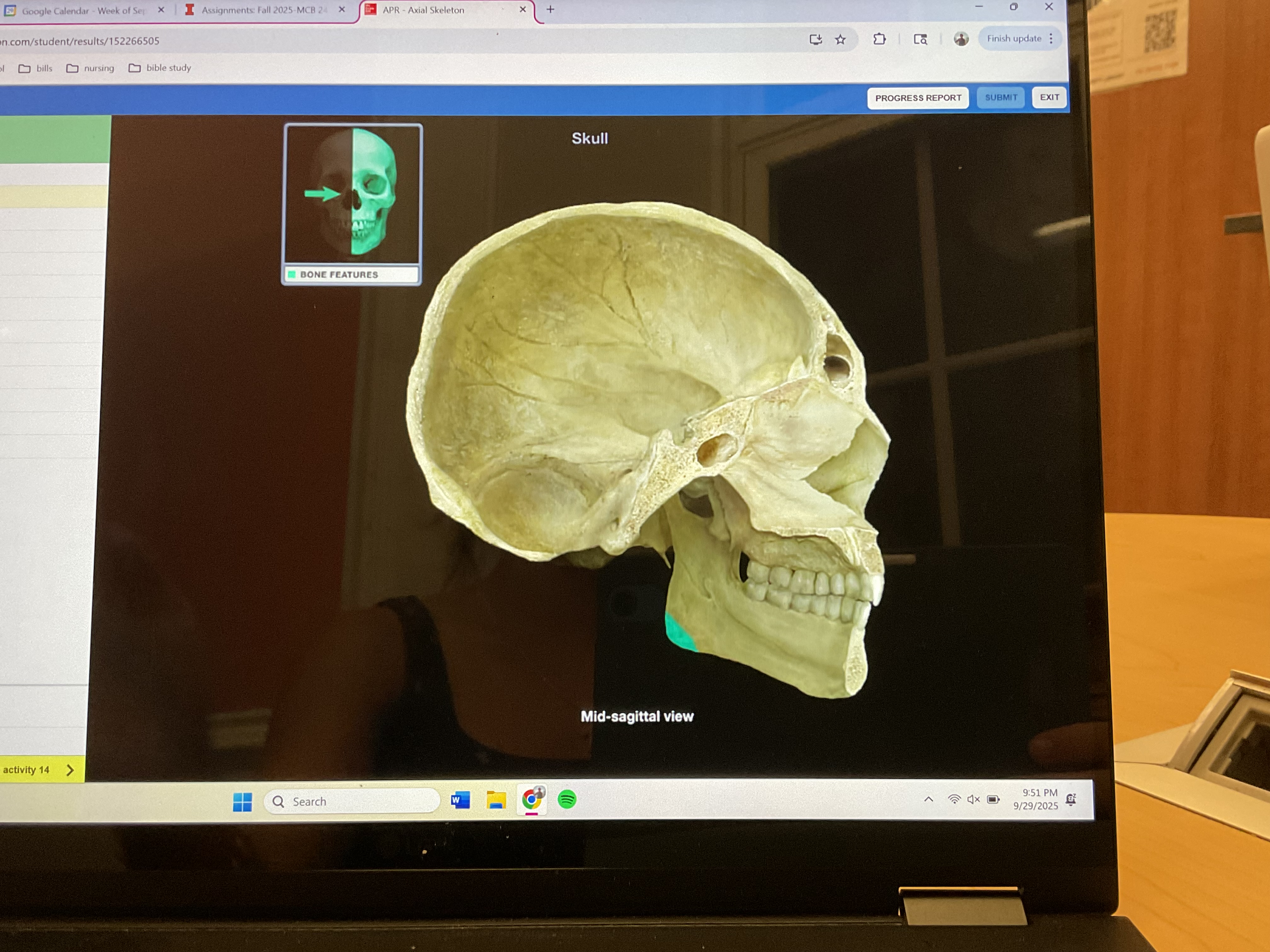 <p>Angle of mandible</p>