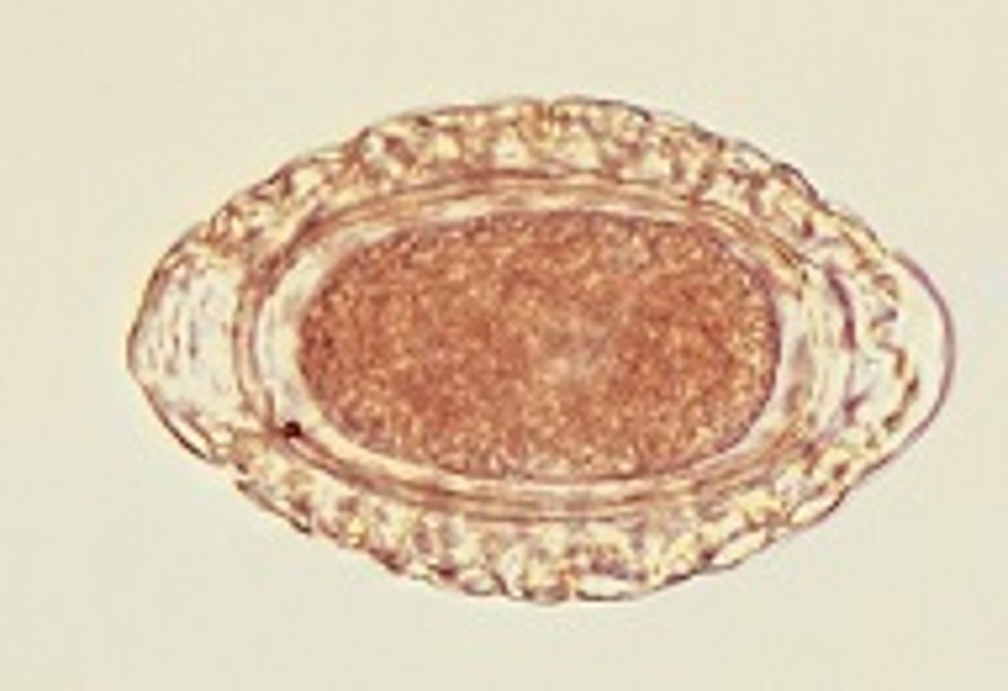 <p>Dioctophyma renale</p>