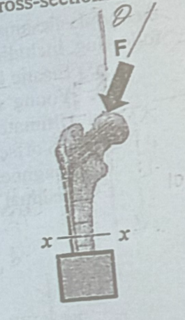 <p>True or False: Is it possible for the maximum tensile stress produced by force F on cross-section xx to be greater than the maximum compressive stress</p>