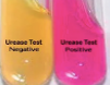 <table style="min-width: 113px;"><colgroup><col style="width: 88px;"><col style="min-width: 25px;"></colgroup><tbody><tr><td colspan="1" rowspan="1" colwidth="88" style="width: 61.4pt; border: 1pt solid windowtext; padding: 0cm 5.4pt; height: 48.8pt;"><p class="MsoNormal"><span><strong><span>Urease test</span></strong></span></p></td><td colspan="1" rowspan="1" style="width: 173.8pt; border-top: 1pt solid windowtext; border-right: 1pt solid windowtext; border-bottom: 1pt solid windowtext; border-image: initial; border-left: none; padding: 0cm 5.4pt; height: 48.8pt;"><p class="MsoNormal"><span><span>+ = pink colour</span></span></p><p class="MsoNormal"></p><p class="MsoNormal"></p><p class="MsoNormal"><span><span>- = stays orange</span></span></p></td></tr></tbody></table><p></p>