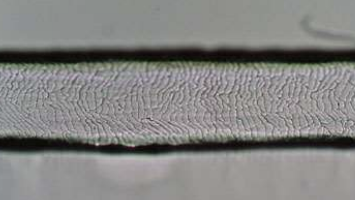 <p>Pattern found in human hair.</p>