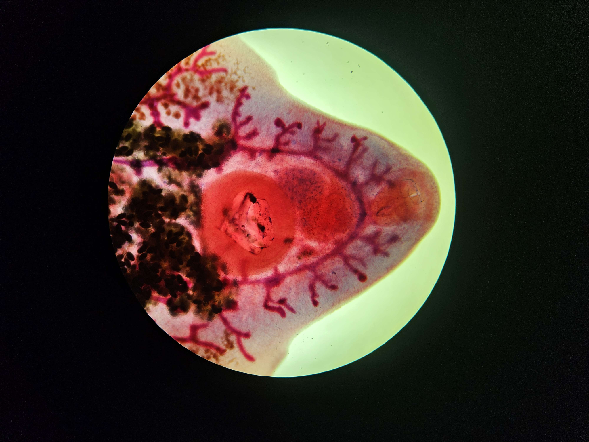 <p><span data-name="microscope" data-type="emoji">🔬</span><span data-name="petri_dish" data-type="emoji">🧫</span><strong><span> </span>Na podstawie zdjęcia preparatu:</strong></p><p></p><ul><li><p><span data-name="book" data-type="emoji">📖</span><span> </span>rozpoznaj gatunek pasożyta;</p></li></ul><p></p><ul><li><p><span data-name="recycle" data-type="emoji">♻</span><span> </span>rozpoznaj wszystkie formy rozwojowe;</p></li></ul><p></p><ul><li><p><span data-name="microbe" data-type="emoji">🦠</span><span> </span>wskaż organelle i cechy charakterystyczne dla danego gatunku;</p></li></ul><p></p><ul><li><p><span data-name="mask" data-type="emoji">😷</span><span> </span>nazwij chorobę, którą pasożyt wywołuje.</p></li></ul><p></p>
